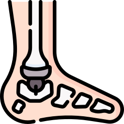 Ankle